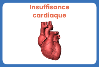 Supports Insuffisance Cardiaque